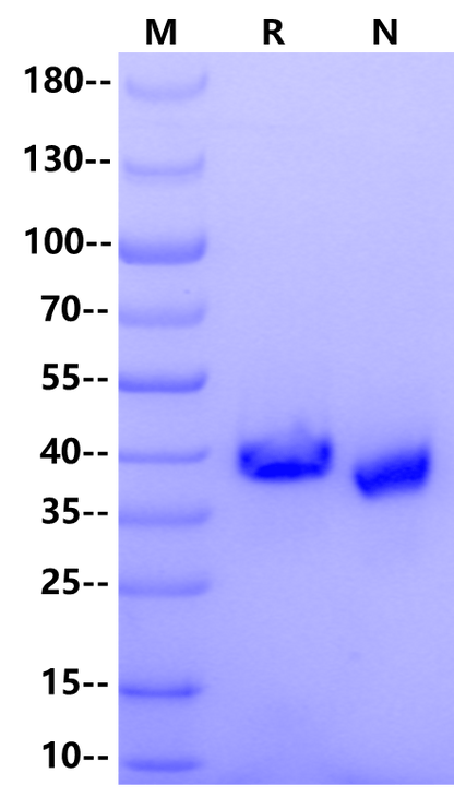 R-spondin-1 Protein, Mouse