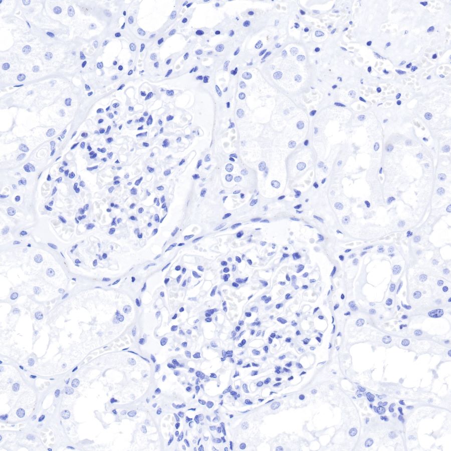 Insulin Recombinant Rabbit mAb (SDT-026-17)