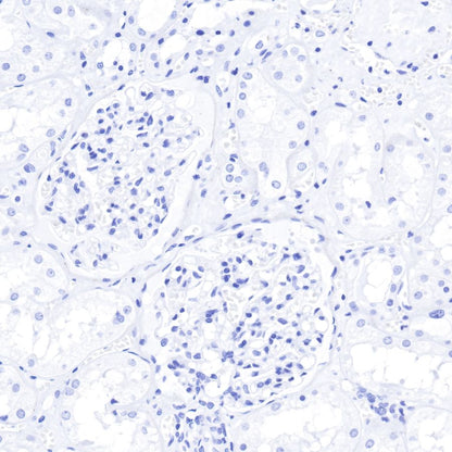 Insulin Recombinant Rabbit mAb (SDT-026-17)
