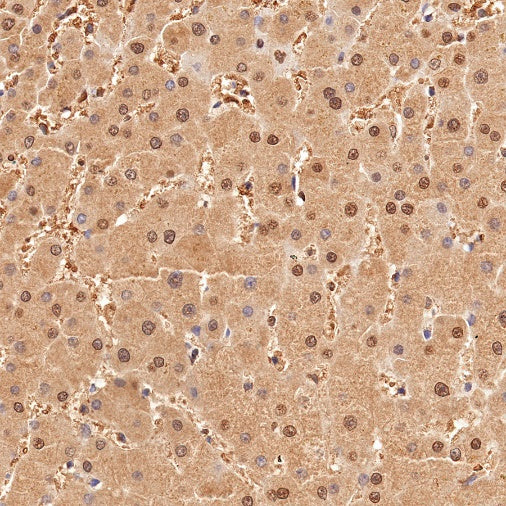 Superoxide Dismutase 1 Recombinant Rabbit mAb (S-1537-39)
