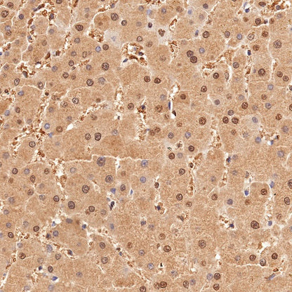 Superoxide Dismutase 1 Recombinant Rabbit mAb (S-1537-39)