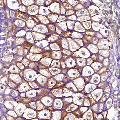 Collagen ll Recombinant Rabbit mAb (S-3360)