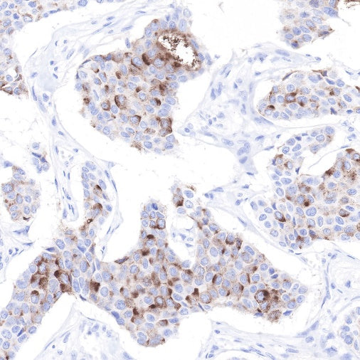S-RMab® GCDFP-15 Recombinant Rabbit mAb (SDT-R030)