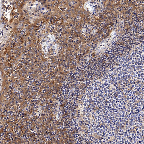 Src Recombinant Rabbit mAb (S-1181-16)