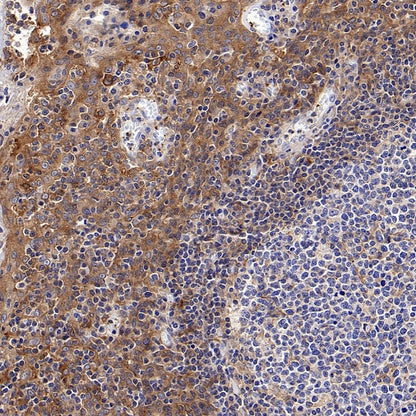 Src Recombinant Rabbit mAb (S-1181-16)