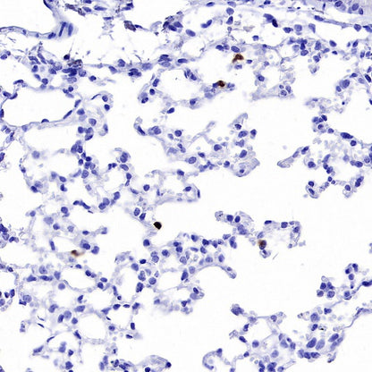 Olfm4 Recombinant Rabbit mAb (S-2748-67)