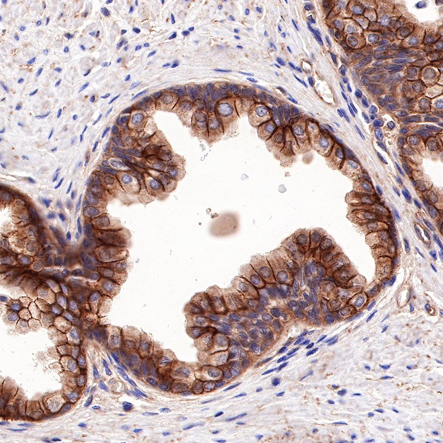 CD155/PVR Recombinant Rabbit mAb (SDT-289-68)