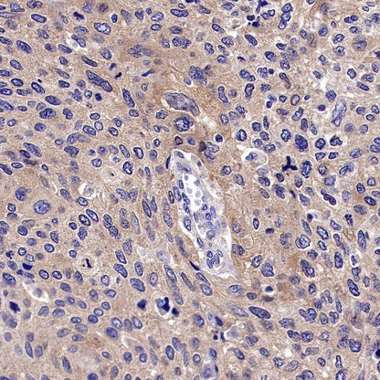 IDE Recombinant Rabbit mAb (S-1051-61)