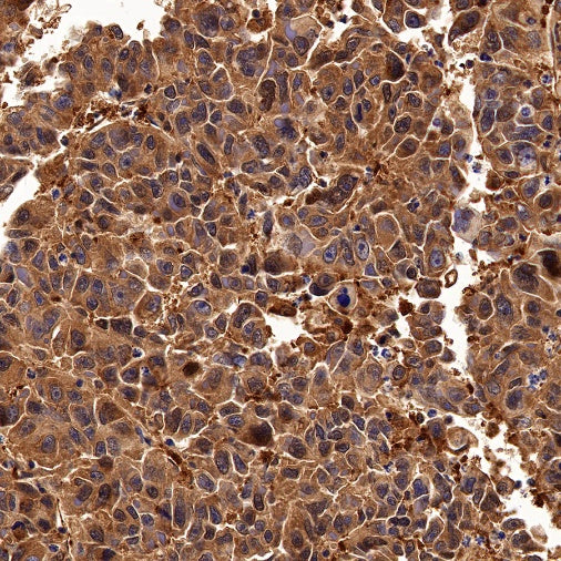 Peroxiredoxin 1/PAG Recombinant Rabbit mAb (S-1673-22)