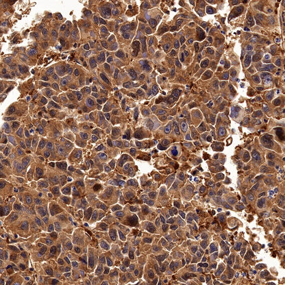 Peroxiredoxin 1/PAG Recombinant Rabbit mAb (S-1673-22)