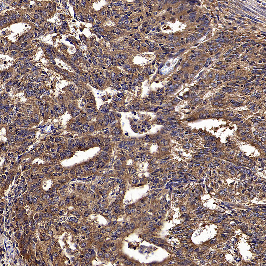 Calpain 1 Recombinant Rabbit mAb (S-3797-41)