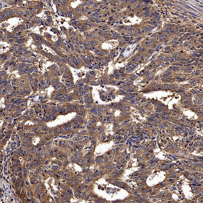 Calpain 1 Recombinant Rabbit mAb (S-3797-41)