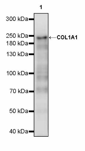 COL1A1 Recombinant Rabbit mAb (S-2975-9)