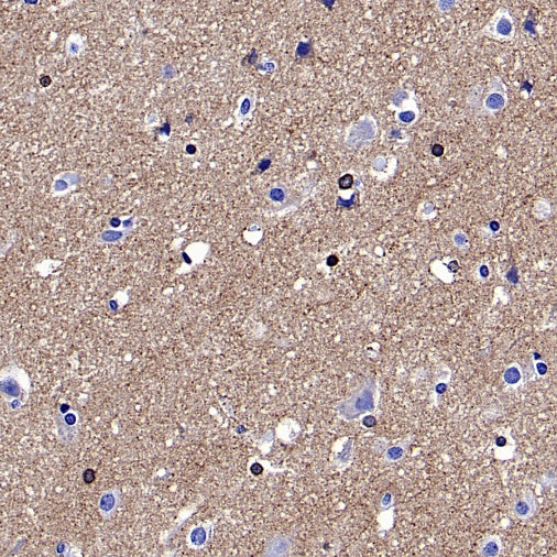 PKC zeta Recombinant Rabbit mAb (S-1306-34)