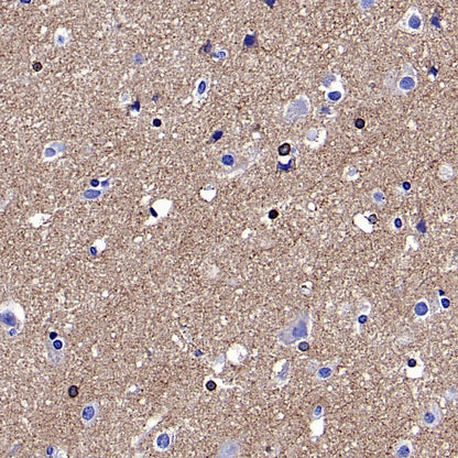 PKC zeta Recombinant Rabbit mAb (S-1306-34)
