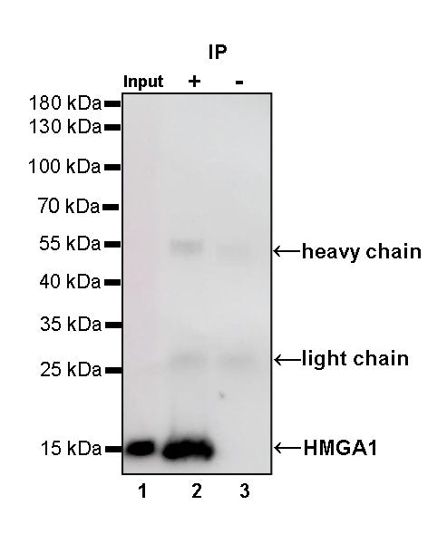 HMGA1 Recombinant Rabbit mAb (S-R332)