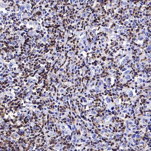 FYN Recombinant Rabbit mAb (S-2157-52)