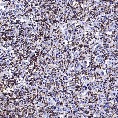 FYN Recombinant Rabbit mAb (S-2157-52)