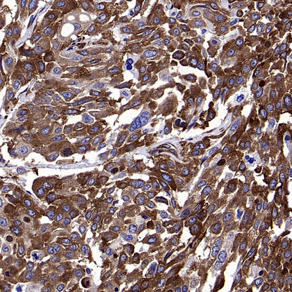 YB1 Recombinant Rabbit mAb (S-1748-144)
