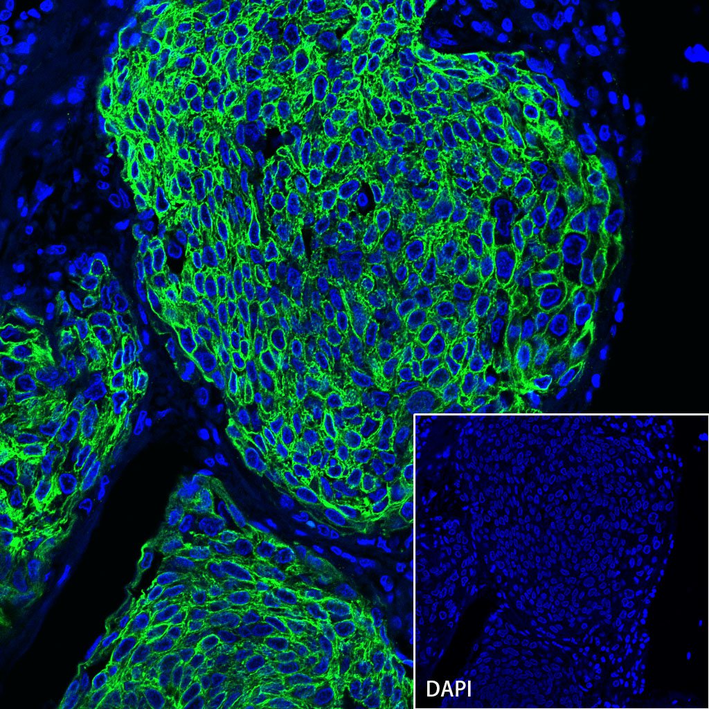 S-RMab® CK-Pan Recombinant Rabbit mAb,PBS Only (SDT-P001)