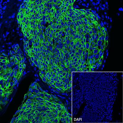 S-RMab® CK-Pan Recombinant Rabbit mAb,PBS Only (SDT-P001)