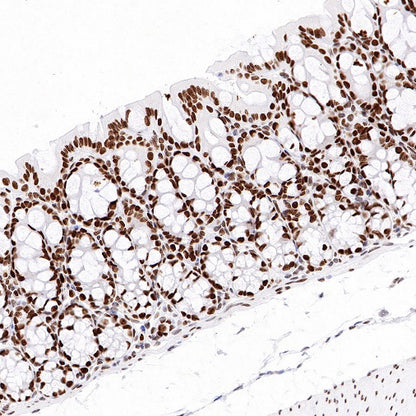 Topoisomerase I/TOP1 Recombinant Rabbit mAb (S-822-60)