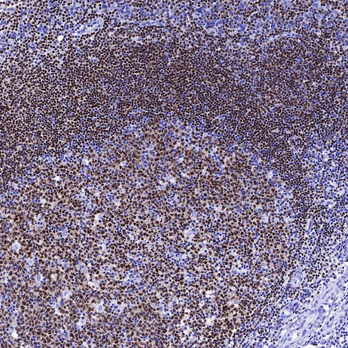 S-RMab® PAX5 Recombinant Rabbit mAb (SDT-R202)