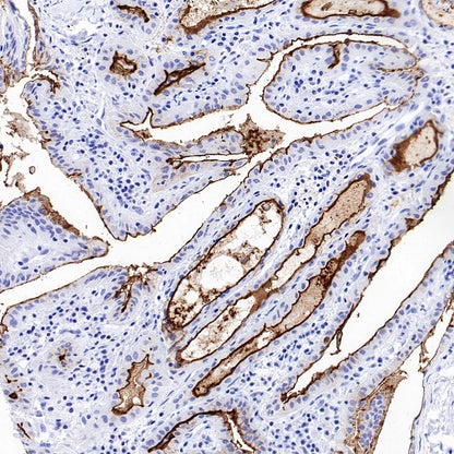 NaPi2b/SLC34A2 Recombinant Rabbit mAb (SDT-1771-79)