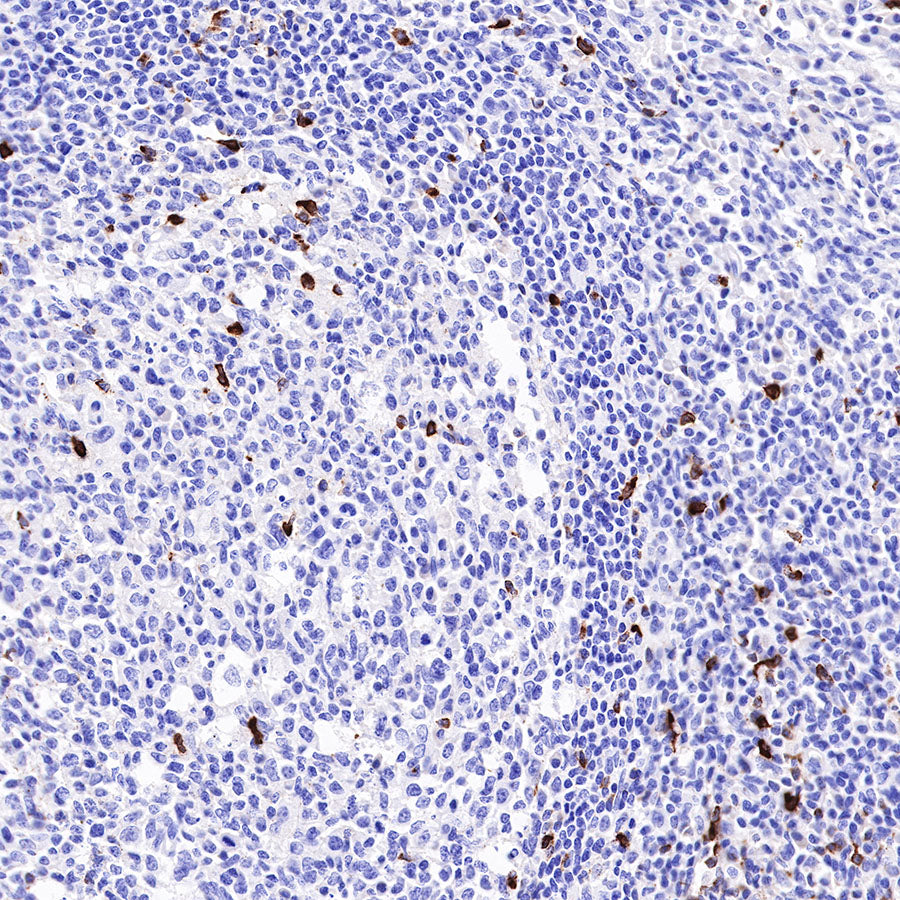 LAG3 Recombinant Rabbit mAb (SDT-R159)