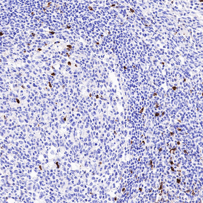 LAG3 Recombinant Rabbit mAb (SDT-R159)