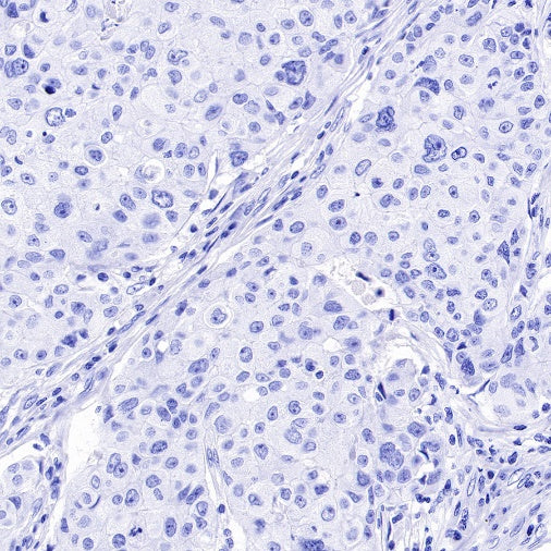 NeuN Recombinant Rabbit mAb (S-392-1)