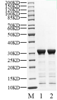 PAK6 His Tag Protein, Human