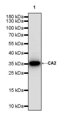 CA2 Rabbit Polyclonal Antibody