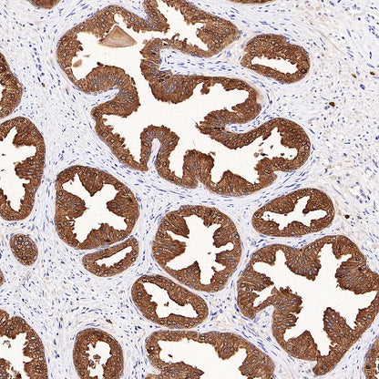 KLK2 Recombinant Rabbit mAb,PBS Only (SDT-4461-80)