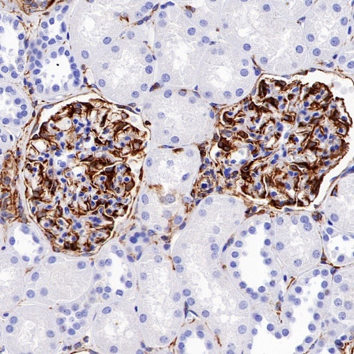 Anti-Rabbit HRP-DAB IHC detection kit