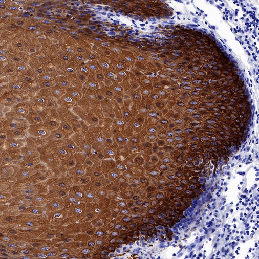 CK-13 Recombinant Rabbit mAb (SDT-641-41)