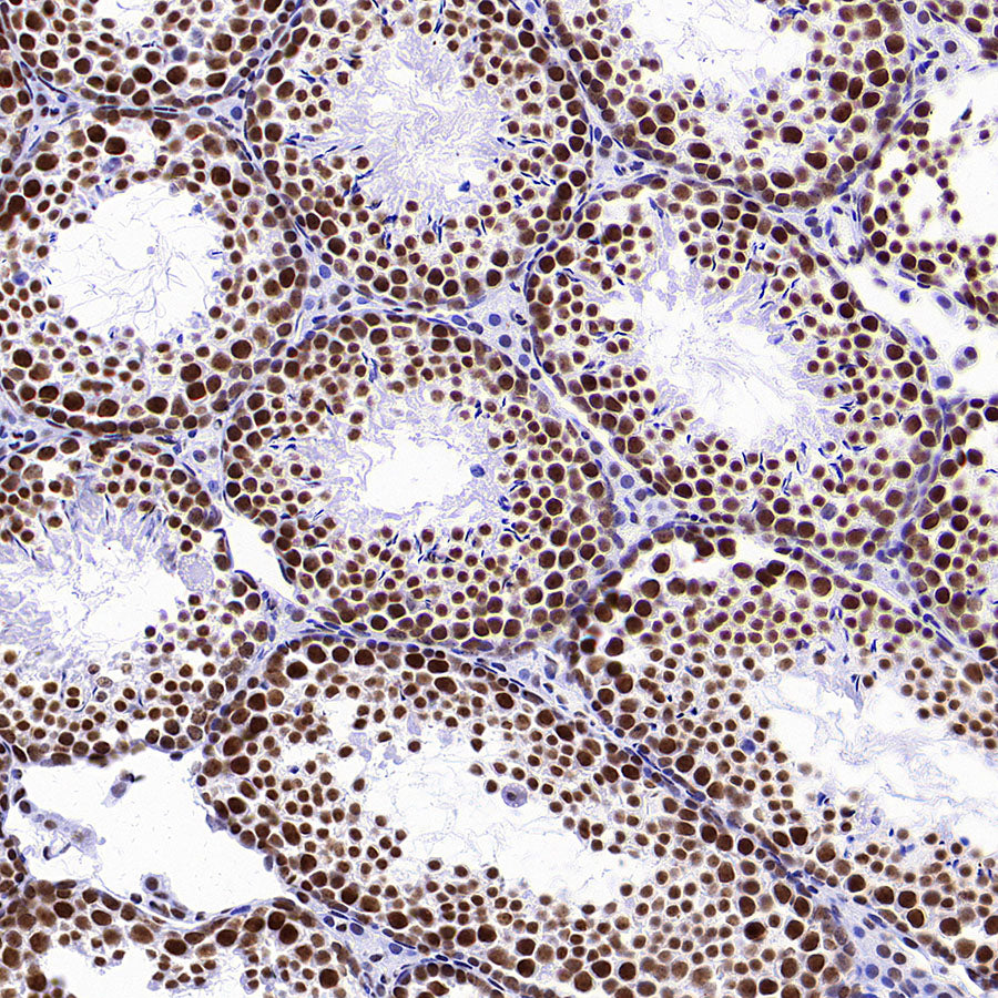 CDK11/CDC2L2/CDK11A Recombinant Rabbit mAb (S-3994-75)