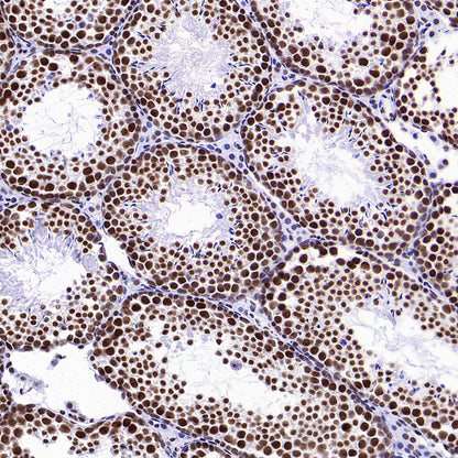 CDK11/CDC2L2/CDK11A Recombinant Rabbit mAb (S-3994-75)