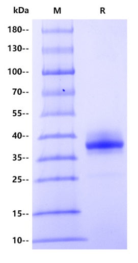 Human ART1 Protein, His tag