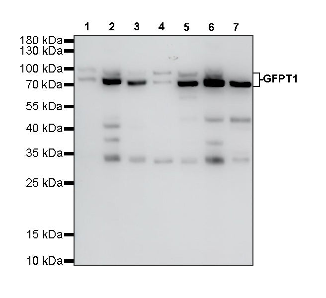 GFPT1 Recombinant Rabbit mAb (S-4752-19)