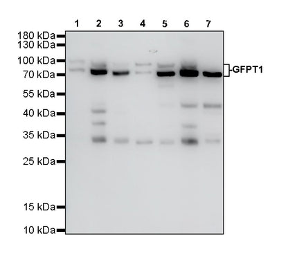 GFPT1 Recombinant Rabbit mAb (S-4752-19)
