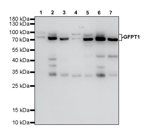 GFPT1 Recombinant Rabbit mAb (S-4752-19)