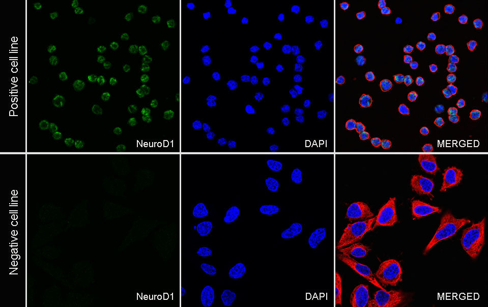 NeuroD1 Recombinant Rabbit mAb (SDT-3843-59)