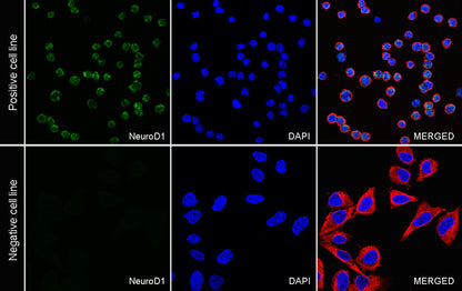 NeuroD1 Recombinant Rabbit mAb (SDT-3843-59)