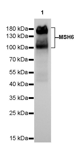 S-RMab® MSH6 Recombinant Rabbit mAb,PBS Only (SDT-R094)