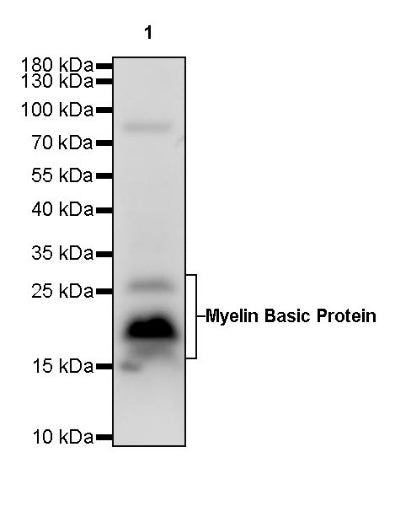 Myelin Basic Protein Recombinant Rabbit mAb (S-582-79)