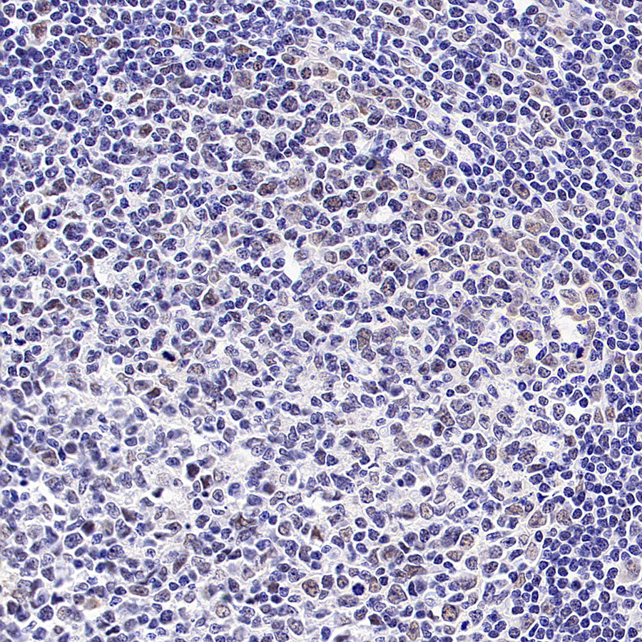 BRCA2 Recombinant Rabbit mAb (S-5306)