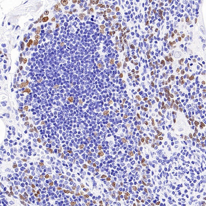 p40 Recombinant Rabbit mAb (SDT-166-116)