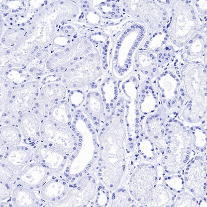 CCL17 Recombinant Rabbit mAb (S-1847-7)