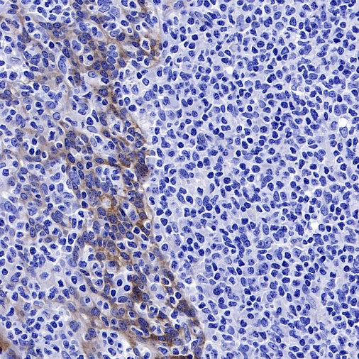 Jagged1 Recombinant Rabbit mAb (S-3296)